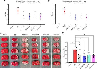 Gasdermin D could be lost in the brain parenchyma infarct core and a pyroptosis-autophagy inhibition effect of Jie-Du-Huo-Xue decoction after stroke